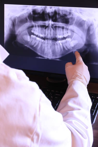 Best Broken or Chipped Tooth Repair in Skidmore, TX